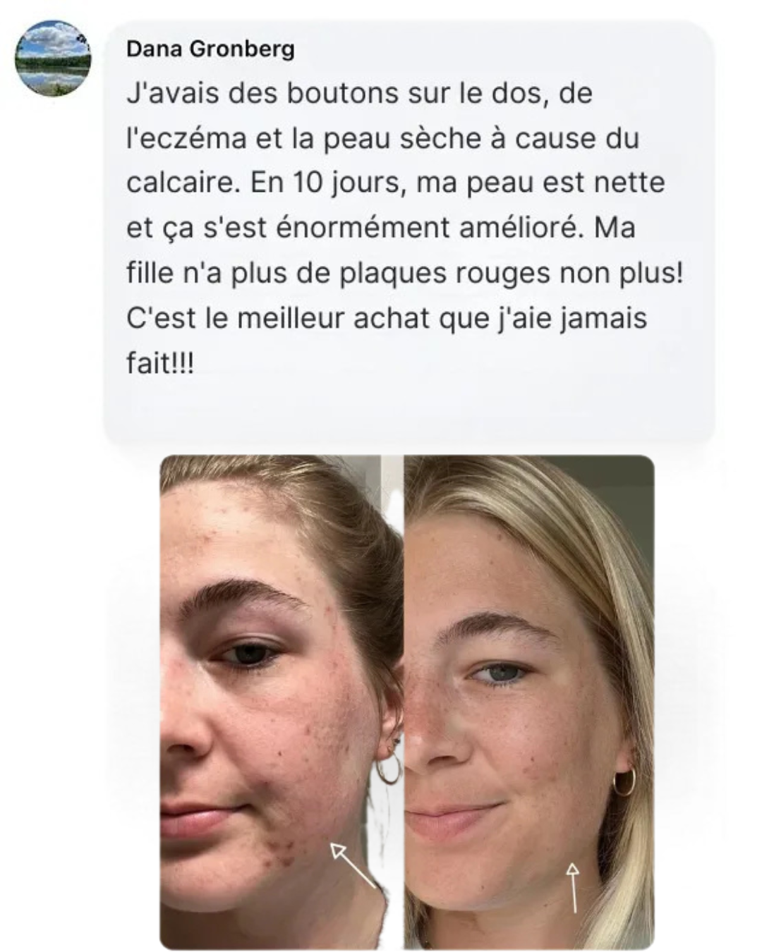 Pommeau de Douche Filtrant