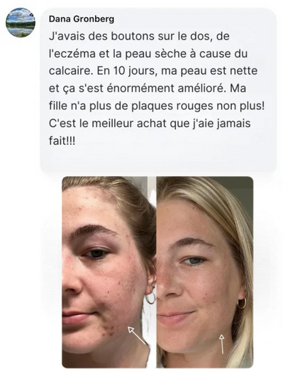 Pommeau de Douche Filtrant